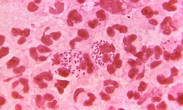 Gonorrhoea could become ‘untreatable’, doctors warn amid rise in antibiotic-resistant cases Gonorrhoea could become ‘untreatable’, doctors warn amid rise in antibiotic-resistant cases