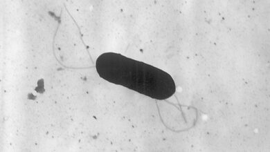 Listeria outbreak which hospitalized 10 people in U.S. linked to prepared foods