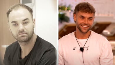 Love Island star unrecognisable in pre-hair transplant video | Lifestyle