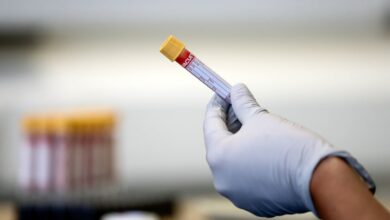 ‘Promising’ new test could detect pancreatic cancer in its early stages