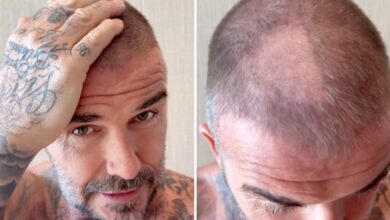David Beckham left with bald patch after ‘terrible’ hair accident